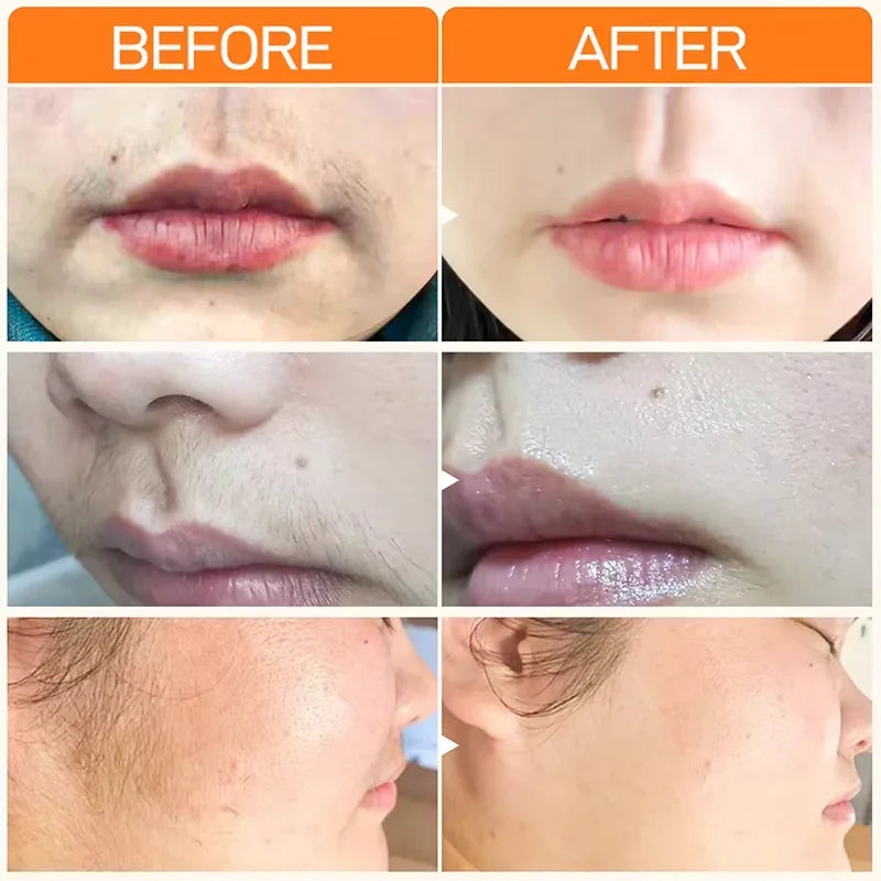3 Minutes Fast Hair Removal Cream Painless Hair Growth Inhibitor Lip Face Arm Armpit Legs Permanent