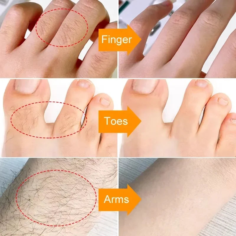 3 Minutes Fast Hair Removal Cream Painless Hair Growth Inhibitor Lip Face Arm Armpit Legs Permanent
